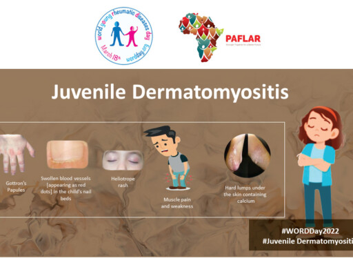 Juvenile Dermatomyositis